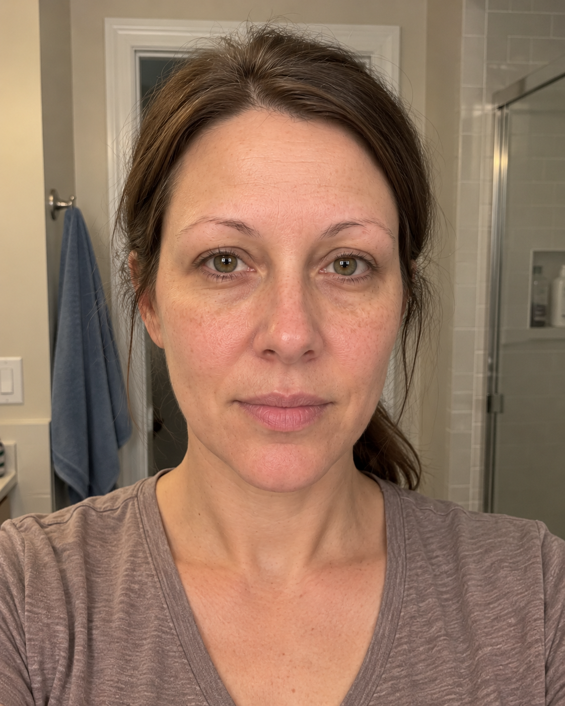 Before eyebrow result